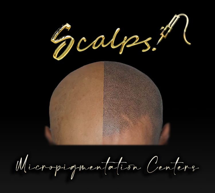 SCALPS LOGO 2 Scalp Micropigmentation & Hairline Restoration Centers | SCALPS