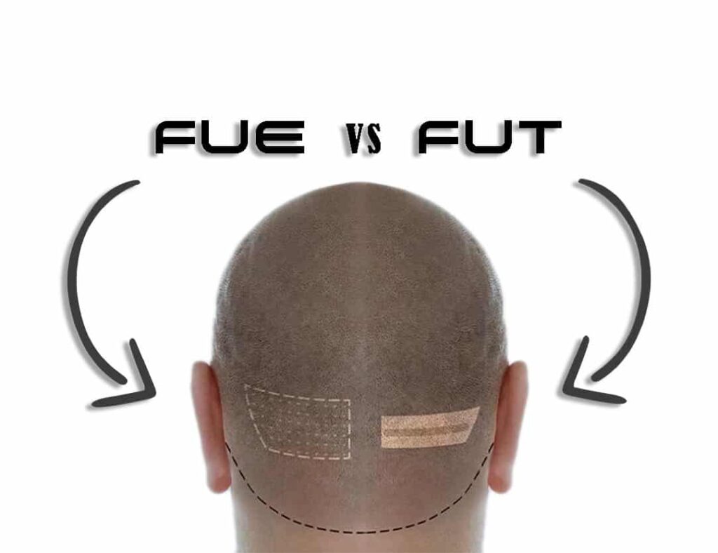 FUT vs FUT SCARS scalpsusa