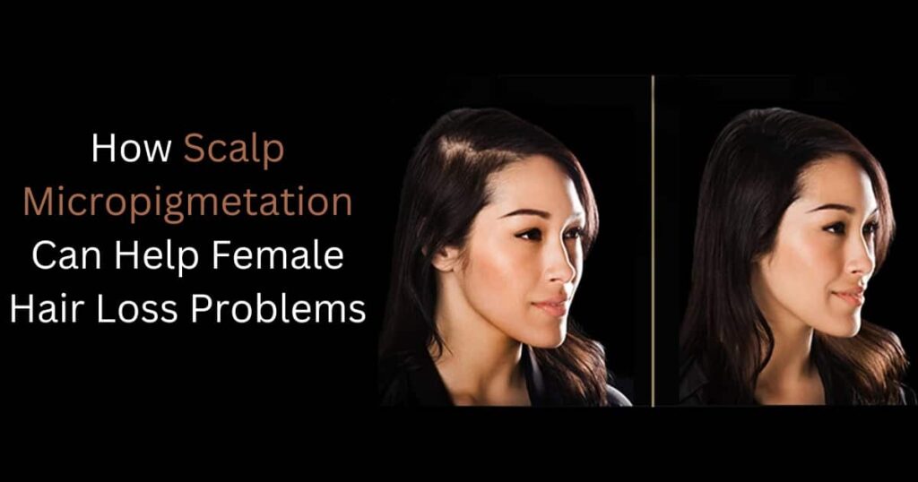 blog 2 SCALPS | Micropigmentation Centers