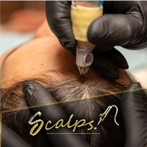 unnamed SCALPS | Micropigmentation Centers