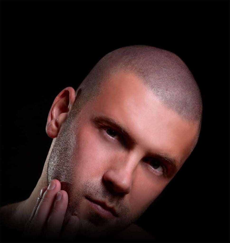 Young and beautiful man touching his own beard with scalp micropigmentation