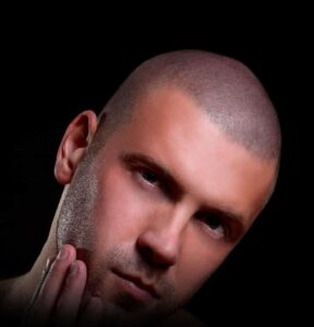 8 Powerful Reasons to Consider a Hair Tattoo for Hair Loss Confidence 5 Young and beautiful man touching his own beard with scalp micropigmentation