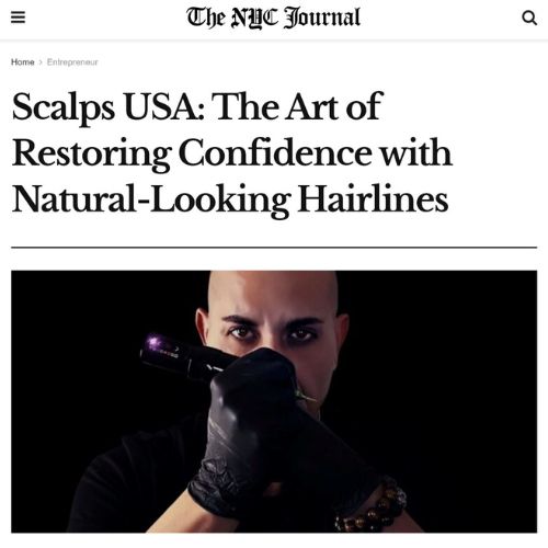 SCALPS CO ® - The Art of Restoring Confidence with Natural-Looking Hairlines