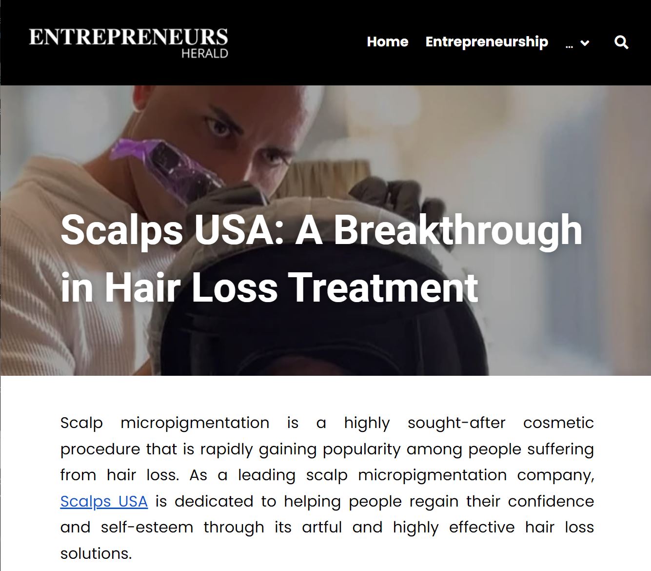 Scalps Co - A Breakthrough in Hair Loss Treatment