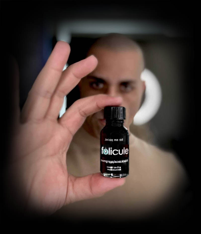 Alex Asher holding bottle of folicule pigment for scalp micropigmentation