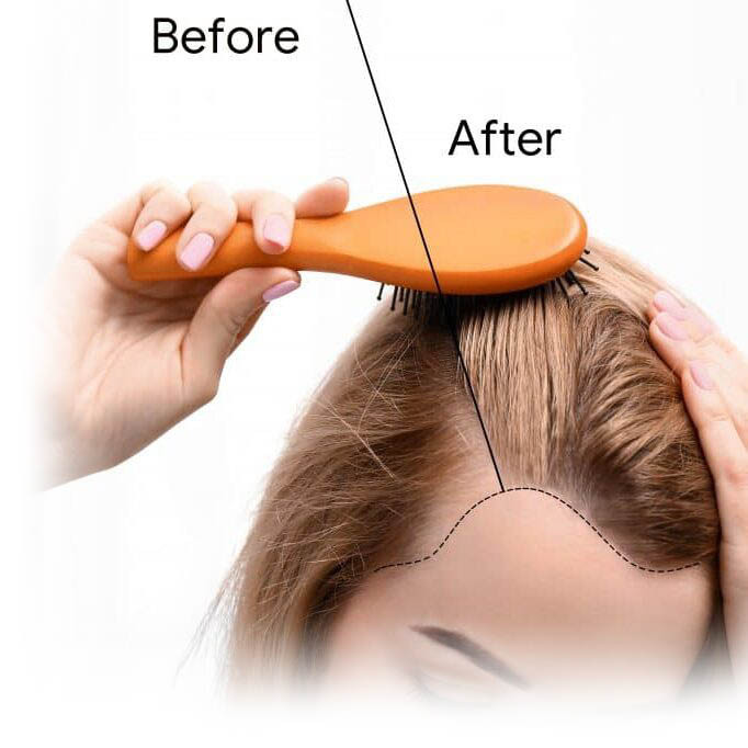 woman brushing hair showing sections with before and after scalp micropigmentation