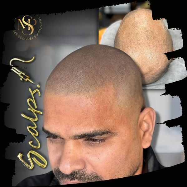 beautiful natural SMP result on Indian man done from SCALPS USA with black background