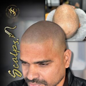 beautiful natural SMP result on indian man done from SCALPS USA