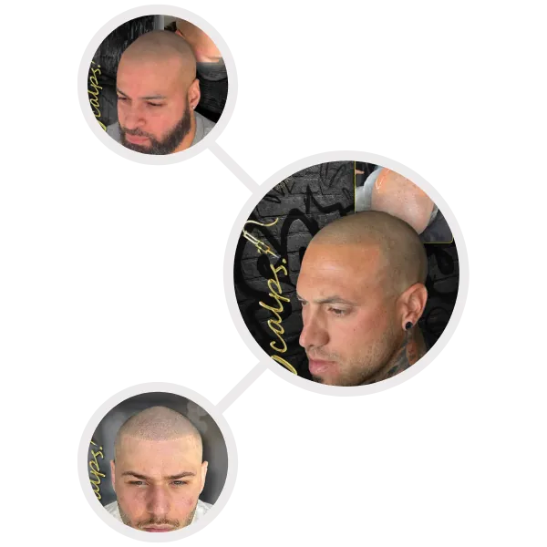 Natural Hairline Tattoo & Scalp Micropigmentation for Men 4 3 image portfolio