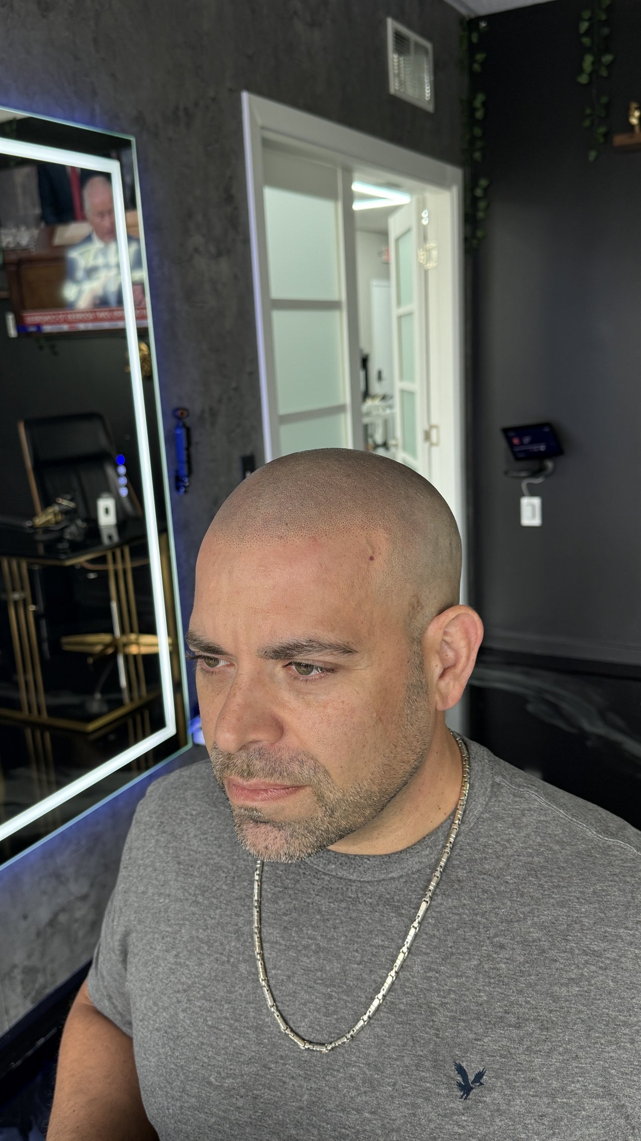 Schedule a Consultation | SCALPS 7 Helder's documented SCALPS result