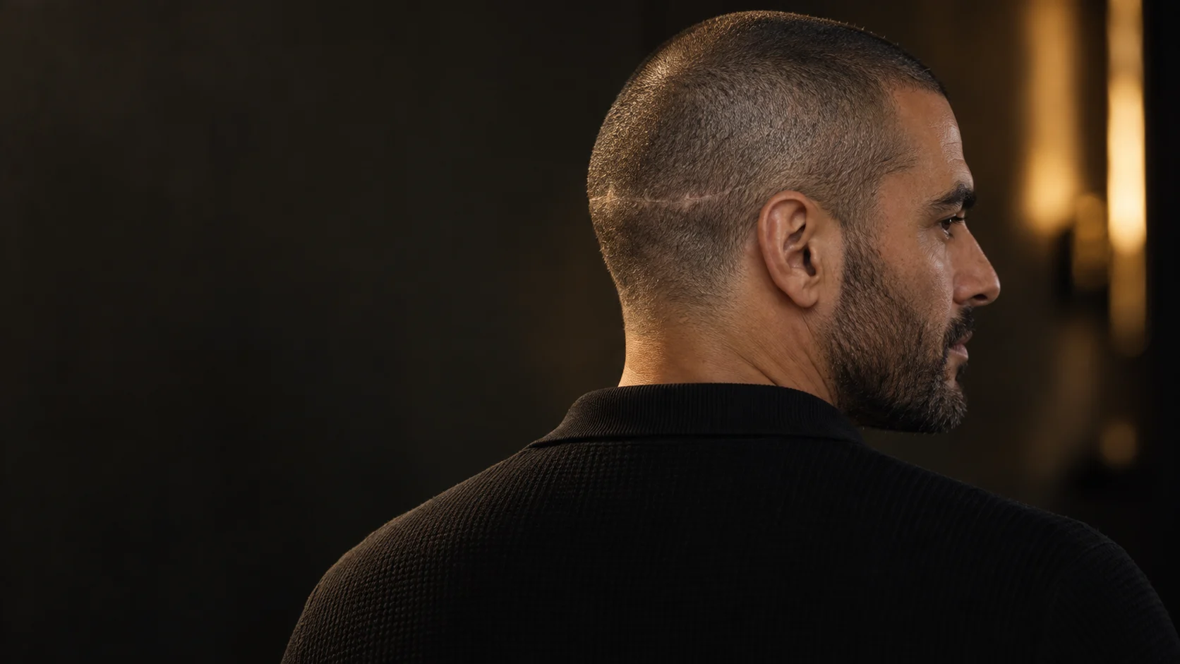 Scar Camouflage Scalp Micropigmentation 1 scalps scar hero editorial v1