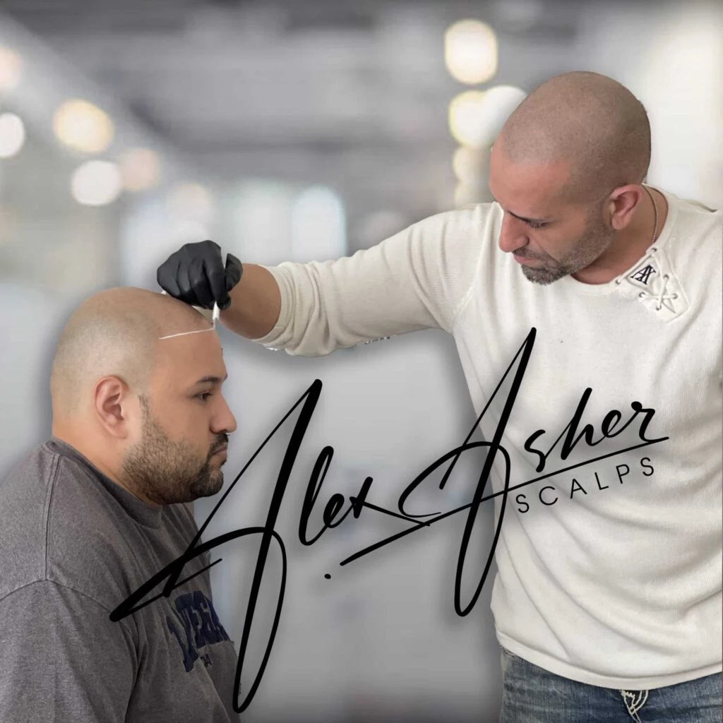 How To Choose a Natural Hairline for SMP, Hairline Tattoos 1 alex hairline draw scaled SCALPS