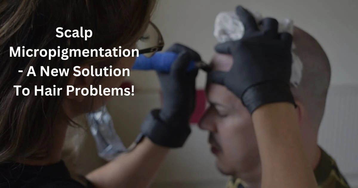 Scalp Micropigmentation - A New Solution To Hair Problems! 1 blog1 3 SCALPS