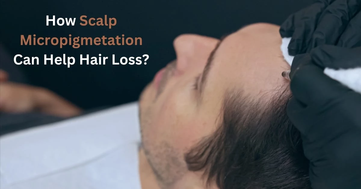 How Scalp Micropigmetation Can Help Hair Loss? 1 blog4 SCALPS
