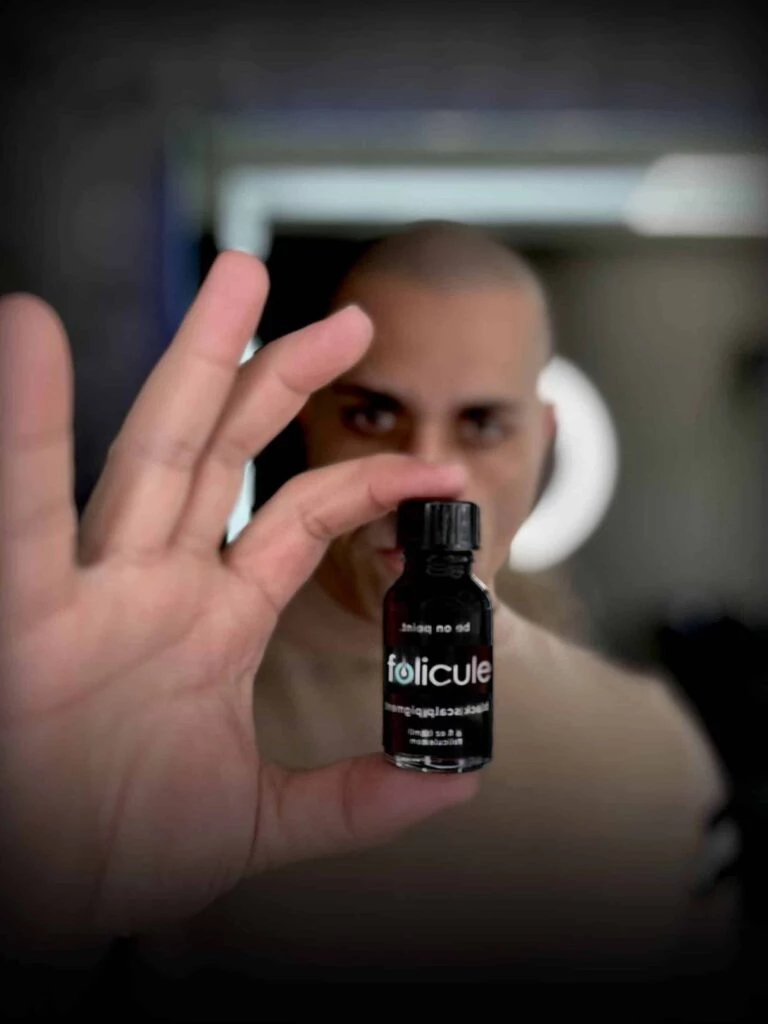 Why Choose Scalps | Scalp Micropigmentation Centers 7 alex asher holding bottle of folicule before scalp micropigmentation procedure